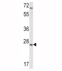 IGFBP4 Antibody