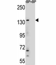 JMJD3 Antibody (KDM6B)