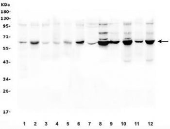 SLC19A1 Antibody
