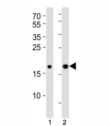 Western blot analysis of lysate from (1) human HepG2 and (2) mouse NIH3T3 cell lines using Hmga2 ant