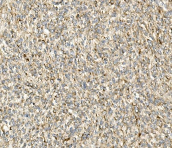 CHOP Antibody / DDIT3 / GADD153
