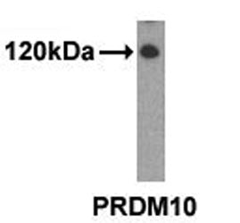 PRDM10 Antibody