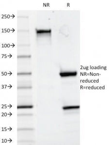 SDS-PAGE Analysis of Purified, BSA-Free CD20 Antibody (clone 93-1B3). Confirmation of Integrity and 