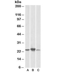 ABHD14B Antibody