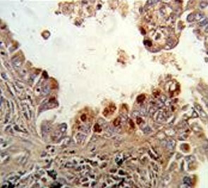 PRKCA Antibody / PKC alpha