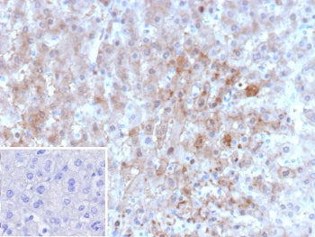 IHC staining of FFPE human liver tissue with ARK1C1 antibody (clone AKR1C1/9062). Inset: PBS used in