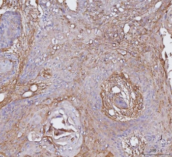 Integrin alpha V Antibody / ITGAV / Vitronectin Receptor