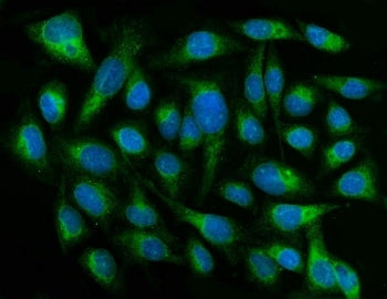 CYB5R3 Antibody