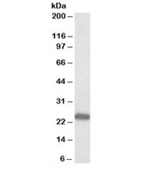 GM2A Antibody