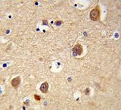 IHC testing of FFPE human brain tissue with AIF antibody. HIER: steam section in pH6 citrate buffer 