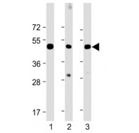 CHRNE Antibody / Acetylcholine receptor subunit epsilon (Center Region)
