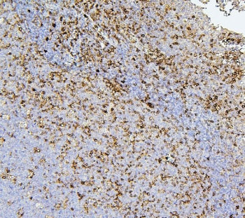 CD43 Antibody