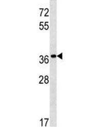 PGA5 Antibody