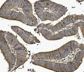 UNG Antibody / Uracil-DNA Glycosylase