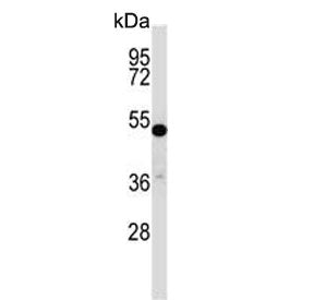 CRTR-1 Antibody / TFCP2L1
