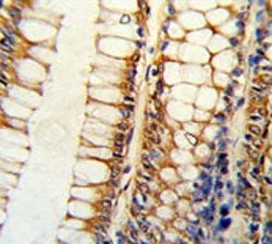 Bim Antibody / BCL2L11