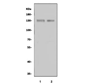 Western blot testing of 1) rat brain and 2) mouse brain tissue lysate with NTRK3 antibody. Predicted
