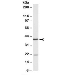 Western blot testing of Daudi lysate with KLHDC8B antibody at 0.5ug/ml. The expected ~38kDa band and