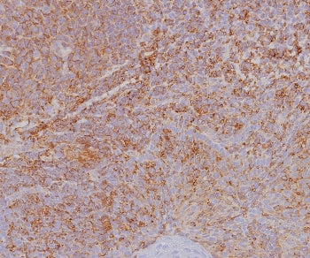 IHC staining of FFPE human tonsil tissue with HLA-ABC antibody (clone MHC-I/8366R). HIER: boil tissu