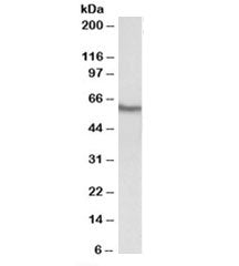 Western blot testing of human kidney lysate with GGT1 antibody at 0.3ug/ml. Predicted molecular weig