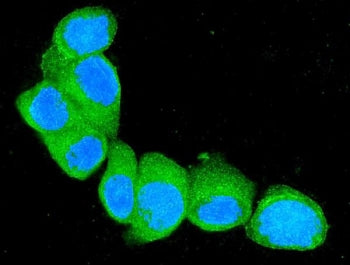 Immunofluorescent staining of FFPE human MCF7 cells with S100A4 antibody (green) and DAPI nuclear st