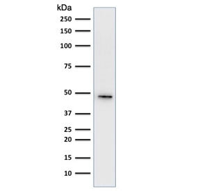 KRT19 Antibody Cocktail / Cytokeratin 19