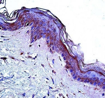 CD1a antibody immunohistochemistry analysis in formalin fixed and paraffin embedded human skin tissu