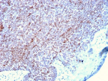p73 Antibody / Tumor Protein 73