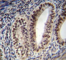 Progesterone Receptor antibody immunohistochemistry analysis in formalin fixed and paraffin embedded