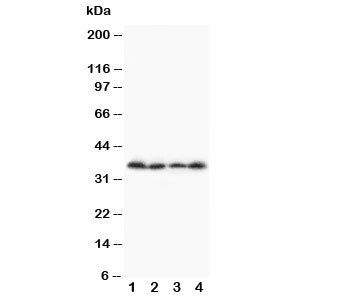 Western blot testing of Stra8 antibody and Lane 1: A231; 2: Jurkat; 3: HT1080; 4: SCG cell lysate. P