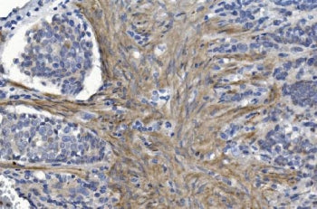 Alpha B Crystallin Antibody / CRYAB