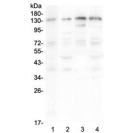 EPS15 Antibody / Epidermal growth factor receptor substrate 15