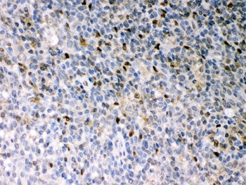 IHC testing of FFPE human tonsil with PU.1 antibody. HIER: Boil the paraffin sections in pH 6, 10mM 