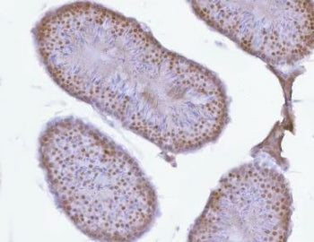 IHC staining of FFPE mouse testis tissue with PRPF18 antibody. HIER: boil tissue sections in pH8 EDT