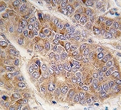 Apolipoprotein A-II Antibody