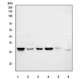 Western blot testing of 1) human Jurkat, 2) human HepG2, 3) human U-2 OS, 4) human K562, 5) rat L6 a