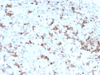 Prolactin Antibody / PRL