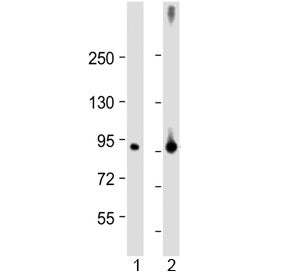 Factor XIIIa Antibody / F13A1 (N-Terminal Region)