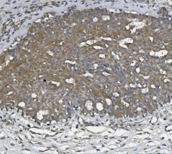 ULBP1 Antibody