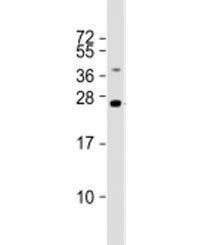 TMED4 Antibody / Transmembrane emp24 domain-containing protein 4