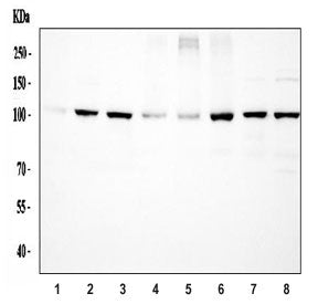 Western blot testing of 1) rat skeletal muscle, 2) rat liver, 3) rat lung, 4) rat RH35, 5) mouse ske