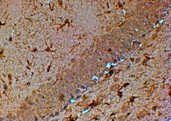 TRPM7 Antibody