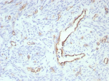 IHC staining of FFPE human uterus tissue with recombinant PECAM antibody (clone rPECAM1/8826). HIER: