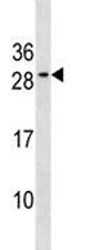 Bcl-2 Antibody