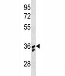 IL-1B Antibody