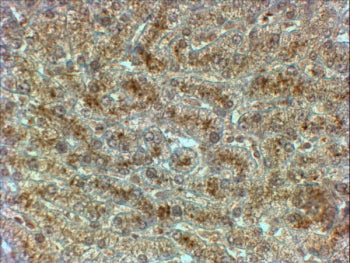 SYVN1 Antibody