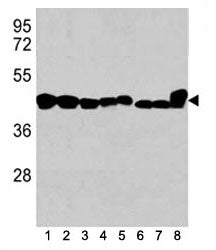 Actin Antibody (beta)