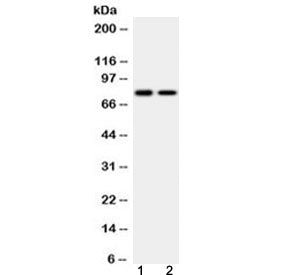 Western blot testing of 1) rat testis and 2) human K562 lysate with GAB1 antibody at 0.5ug/ml. Predi