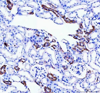 IHC staining of FFPE mouse kidney tissue with Calbindin antibody. HIER: boil tissue sections in pH8 