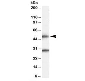 TMPRSS5 Antibody